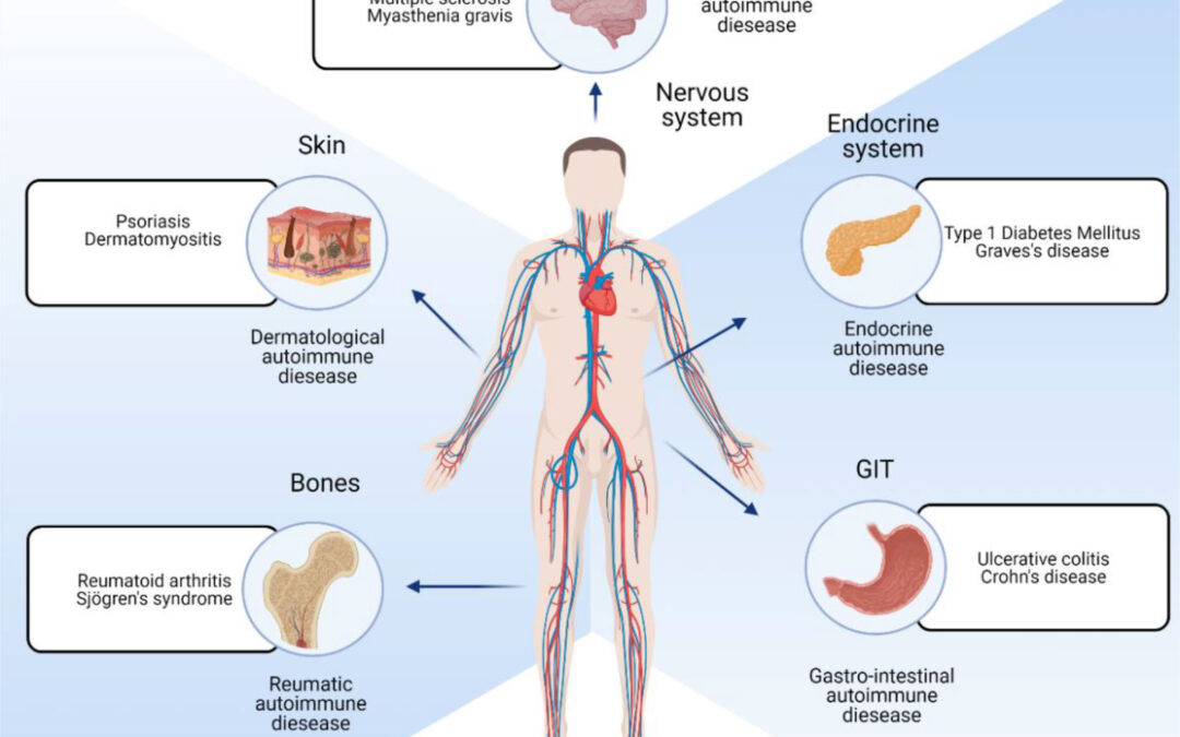Autoimmune Disorders: Causes, Effects, Management, And Hope
