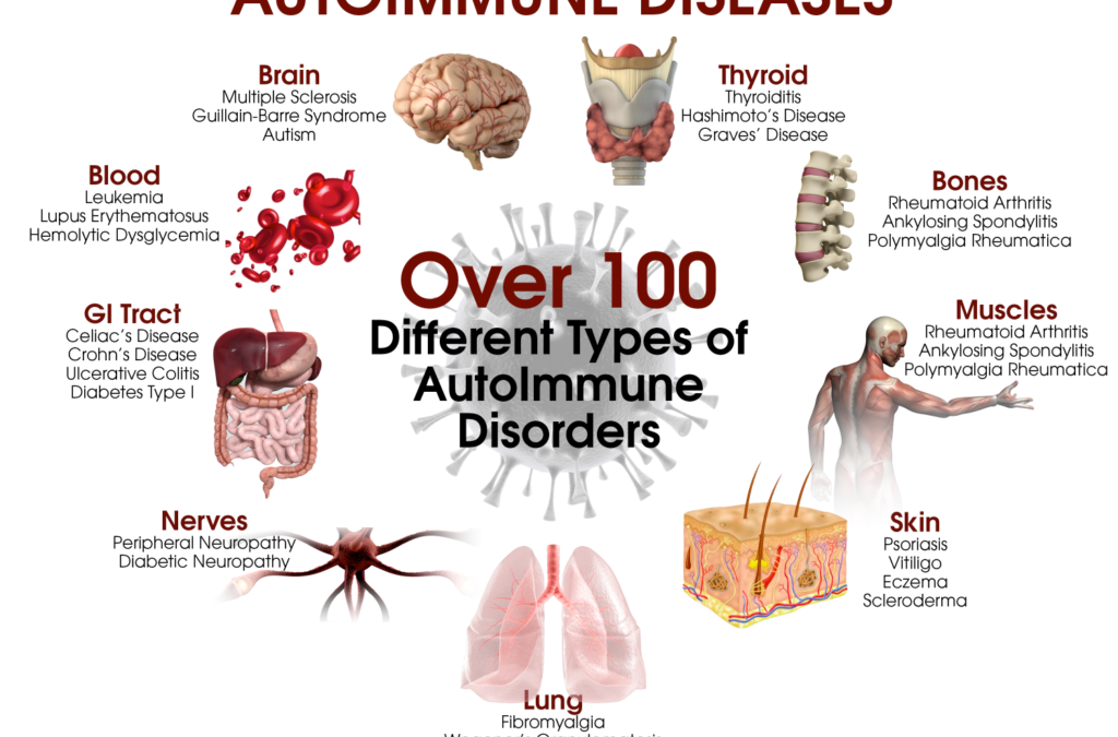 Wouldn’t A Healthy Immune System Make The Autoimmune Disorder Worse?
