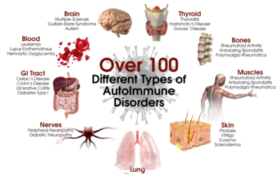 Wouldn’t A Healthy Immune System Make The Autoimmune Disorder Worse?